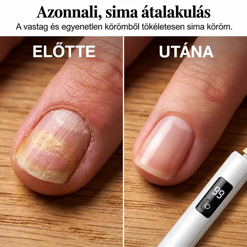|⚡2026-os Óriási Akció 70% KEDVEZMÉNY🔥|✨PurieJoy® 2 az 1-ben Professzionális Elektromos Körömreszelő és Polírozó